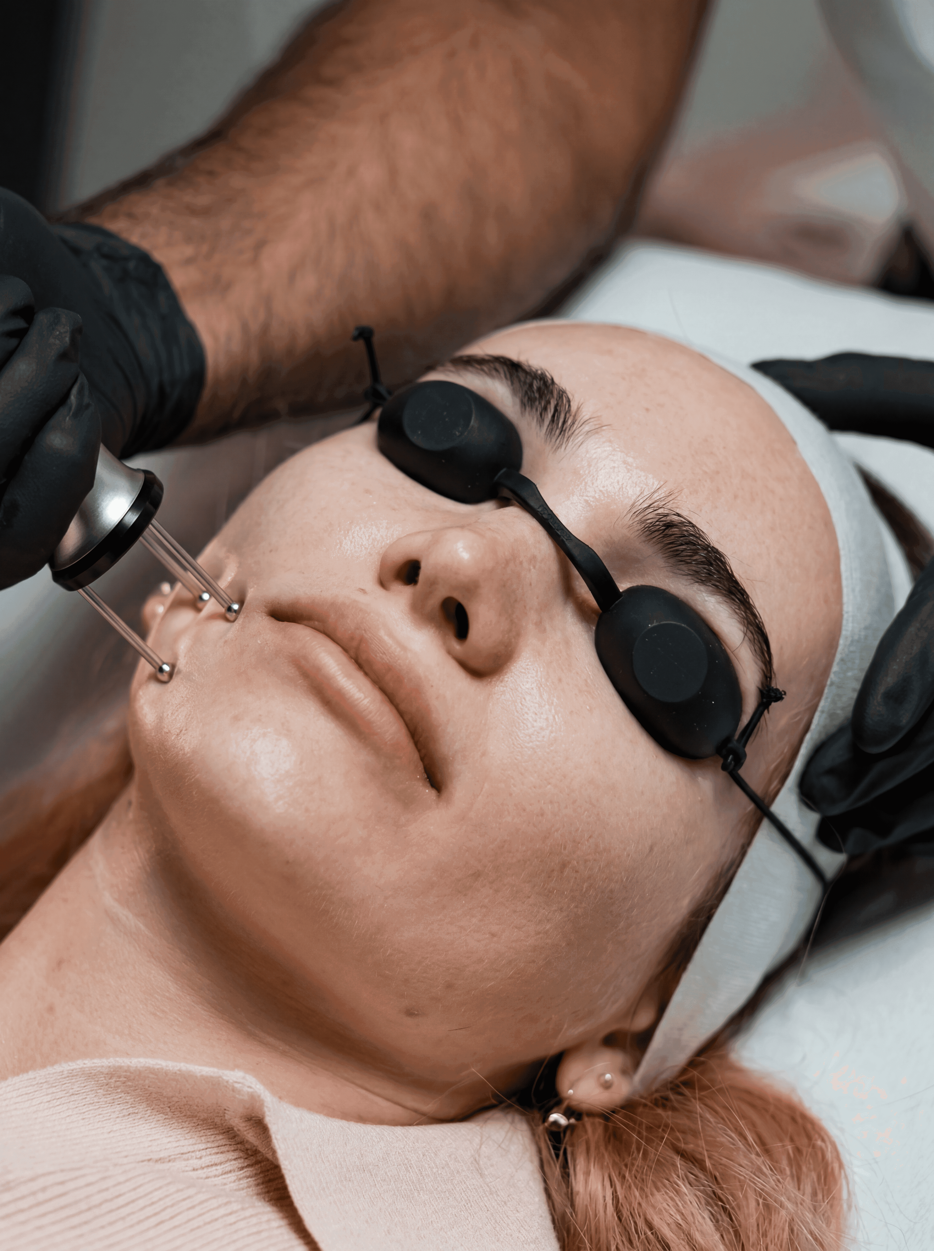 What is laser resurfacing treatment at The One Clinic