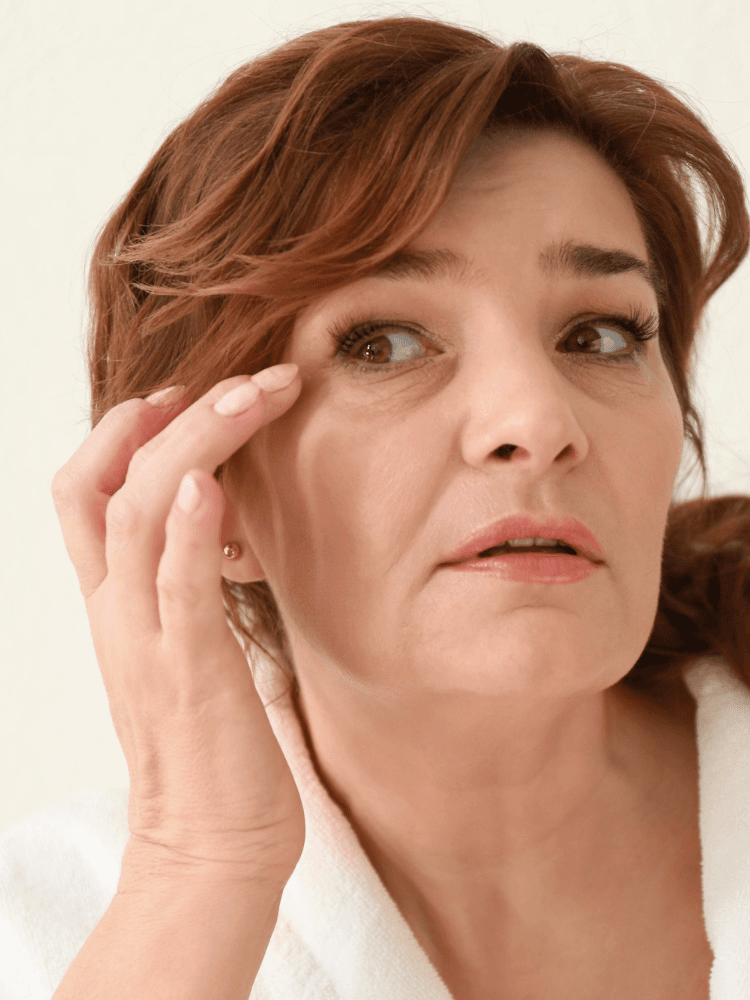 Person showing eye bags under eyes