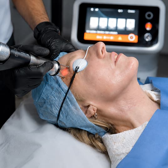 Cool Bleph consultation at The One Clinic
